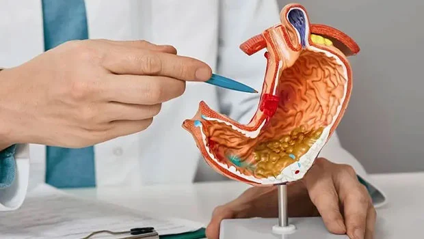 جراحی لاپاراسکوپی سرطان معده